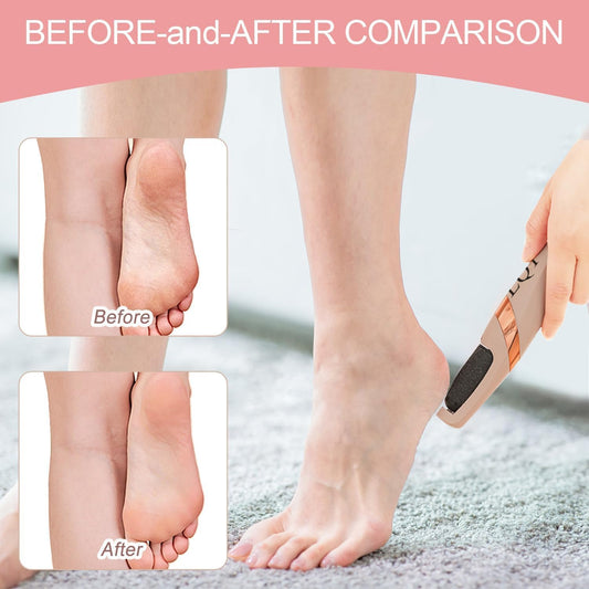Foot Callus Remover